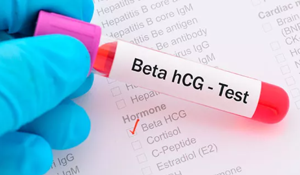 tubo de sangre de prueba hormona hcg